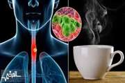 Tea drinking habits and oesophageal cancer in a high risk area in northern Iran, population based case control study
