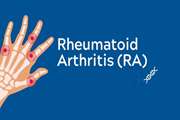Global, regional, and national burden of rheumatoid arthritis, 1990-2020, and projections to 2050: a systematic analysis of the Global Burden of Disease Study 2021