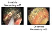Immediate vs. On-demand Endoscopy Necrosectomy in Infected Walled-off Pancreatic Necrosis: A Randomized Controlled Trial